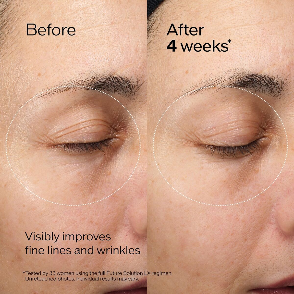 Lip balm Shiseido FUTURE SOLUTION LX 17 ml-7